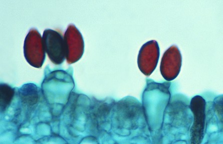 科技名詞|芽孢 spore，gemma